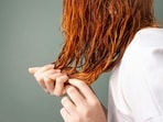 Hair fall signals underlying damage in the body, states Dr Cleo Tetzloff.