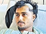 Narrow escape for lensman after rebar plunges from Sewri-Worli Connector