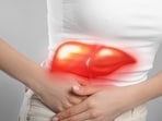 Dietary choices can influence your liver health. 
