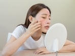 Acne is one of the signs of a compromised gut health. 