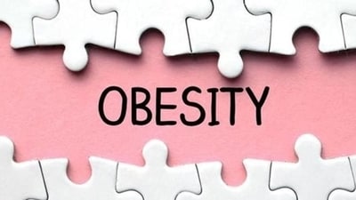 Obesity (Representational image) Obesity (Representational image)