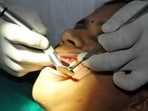 INDORE, India - Oct. 17, 2015: Dentists cheek oral cavity of a patient at a clinic in INDORE, India, on Saturday, October 17, 2015. (Photo by Shankar Mourya/ Hindustan Times) (With Nida's Sunday story) (Hindustan Times)