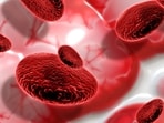 Aplastic anemia is a rare but serious blood disorder where the bone marrow fails to produce enough blood cells. (Freepik)