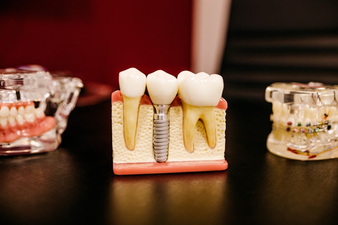The growth of bad bacteria can lead to irritation of the gums, causing inflammation, bleeding, and gum disease. (Unsplash)