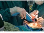 How an engineer’s innovative gun made plastic surgeons’ work easier
