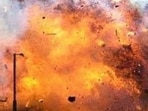 For representation only (HT File Photo)