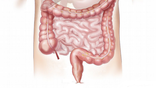 Oncologist explains why right-sided colon cancer is a ‘silent danger’, shares 5 warning signs Oncologist explains why right-sided colon cancer is a ‘silent danger’, shares 5 warning signs