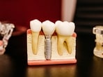 A healthy mouth truly reflects a healthy body. 