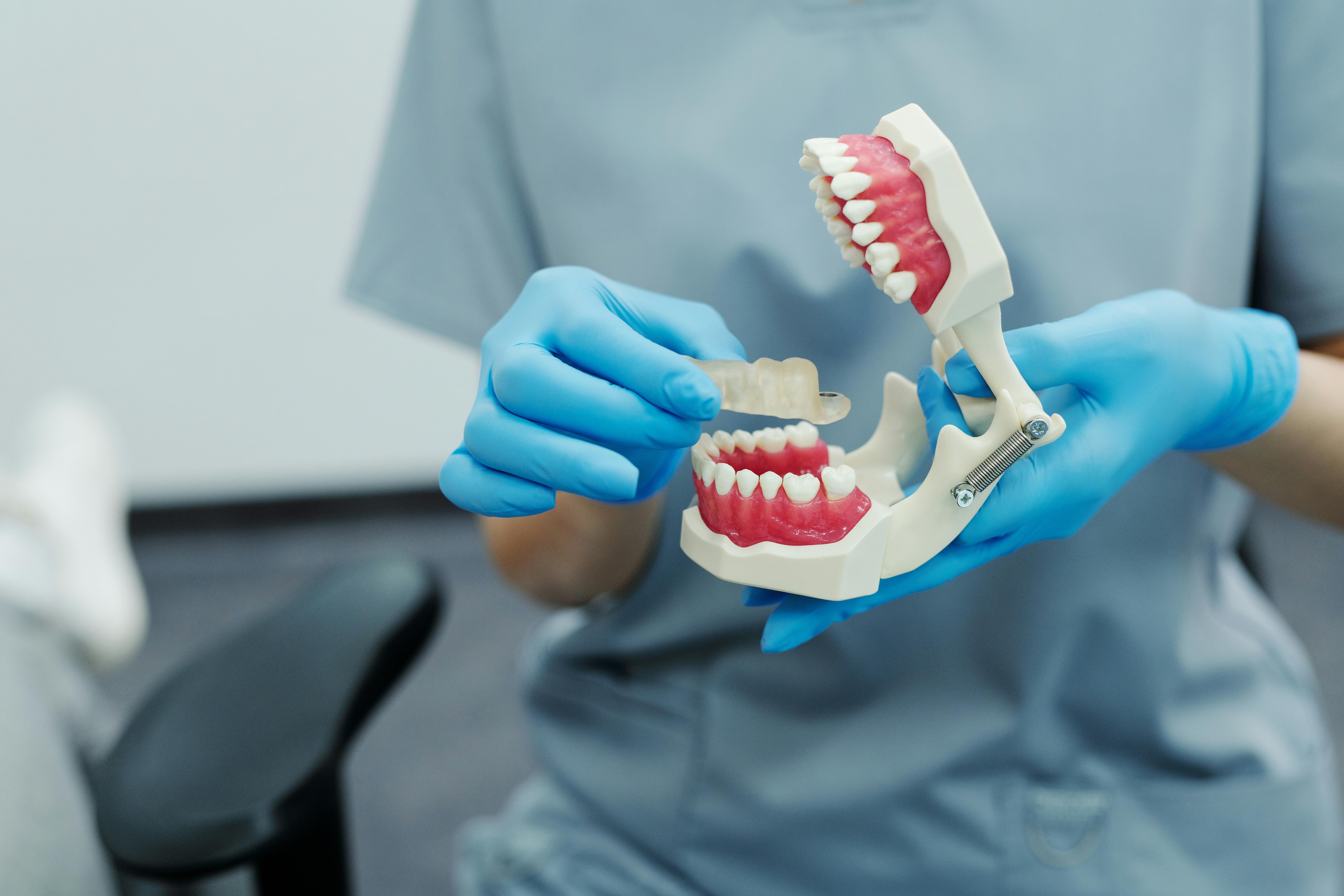Unexplained enamel erosion, especially on the inner surfaces of teeth, can be a sign of acid reflux or gastroesophageal reflux disease. (Pexel) Unexplained enamel erosion, especially on the inner surfaces of teeth, can be a sign of acid reflux or gastroesophageal reflux disease. (Pexel)