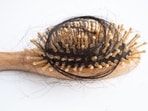 Root-Cause Mapping for Different Types of Hair Loss