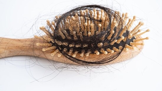 Root-Cause Mapping for Different Types of Hair Loss