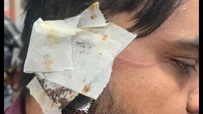 A municipal revenue inspector suffers ear injury after banned kite string cuts him in Lucknow on Sunday (Sourced)