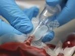 Surprise inspections revealed discrepancies in blood donation records, storage practices, safety protocols. (For Representation)