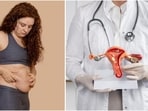 Dr Ritu Dave emphasises that obesity raises the risk of ovarian cancer through hormonal imbalance and chronic inflammation.