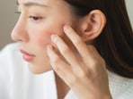 Whether you're inspired by K-beauty or Bollywood, dermatologists says these treatments are now a mainstream standard for healthy, well-maintained skin across all ages and ethnicities.(Shutterstock)