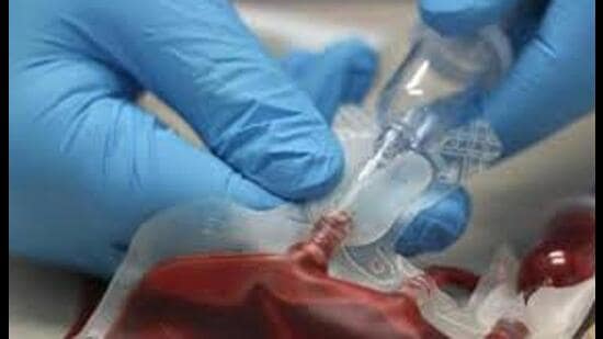 Surprise inspections revealed discrepancies in blood donation records, storage practices, safety protocols. (For Representation)