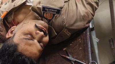 Akash Singh was initially taken to Gonda Medical College and later referred to the KGMU Trauma Centre in Lucknow. (Sourced) Akash Singh was initially taken to Gonda Medical College and later referred to the KGMU Trauma Centre in Lucknow. (Sourced)