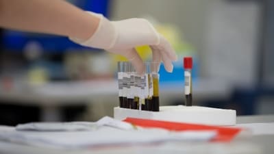 Blood tests are not a medical diagnosis, stresses Dr Rajan. (Unsplash) Blood tests are not a medical diagnosis, stresses Dr Rajan. (Unsplash)