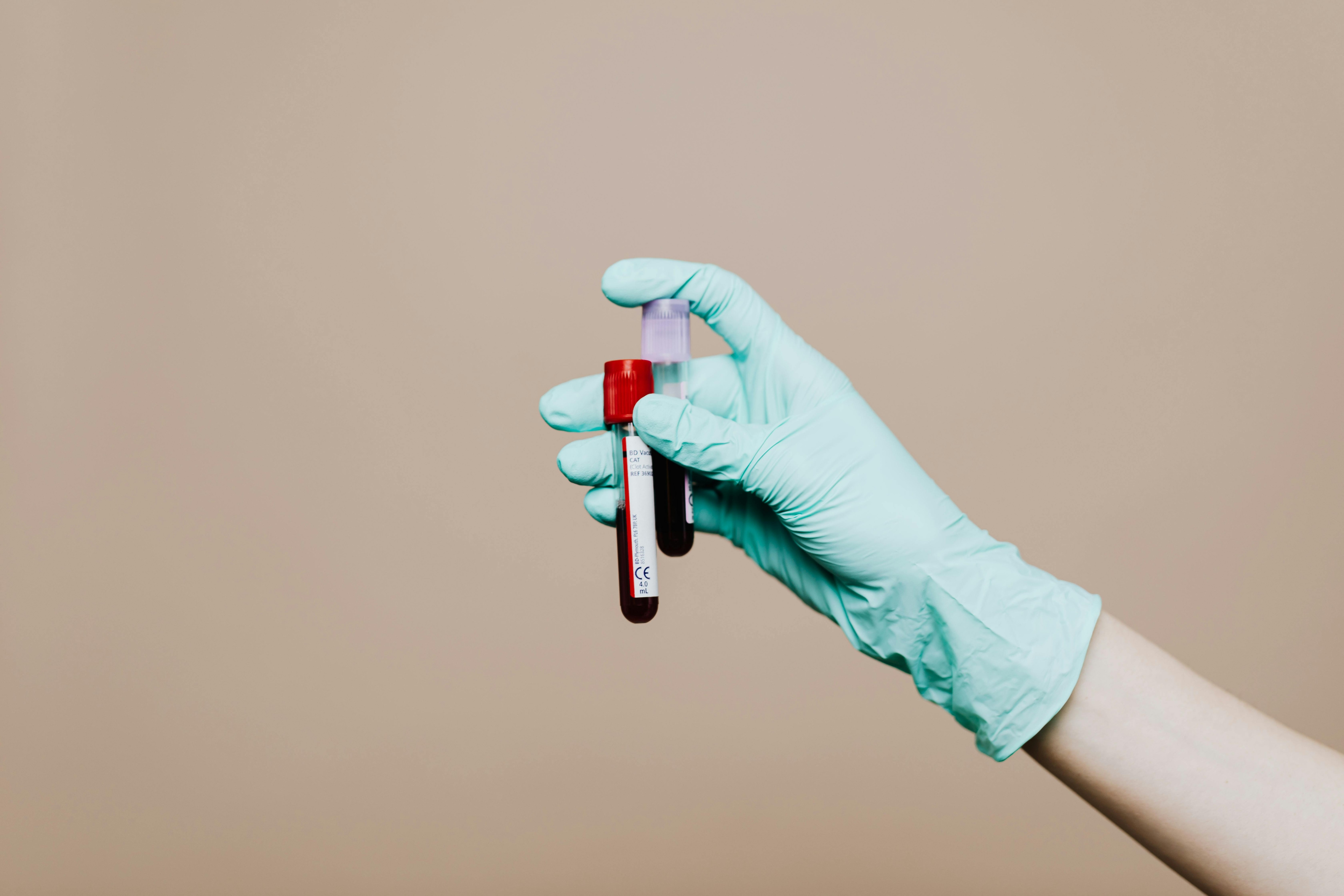 Hormonal tests detect big issues like diabetes and thyroid before they become deadly. (Pexel) Hormonal tests detect big issues like diabetes and thyroid before they become deadly. (Pexel)