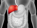 Got questions about fatty liver disease? Here are answers from Dr Sonal Asthana, a liver expert with 20 years of experience. (Freepik)