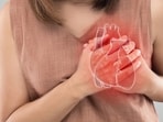 Heart attack symptoms in women are often overlooked.