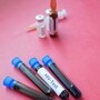 HIV ఇంజెక్షన్‌ ఇచ్చిన ప్రియుడు (Representative Image)