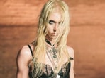 Singer Taylor Momsen shared that she'd been bitten by a spider while performing in Mexico City with AC/DC.