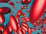 Read more to find out how to manage risks associated with Lp(a)! Read more to find out how to manage risks associated with Lp(a)!