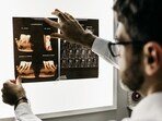 Dental health can help predict colorectal cancer risk, according to Dr Burhenne.