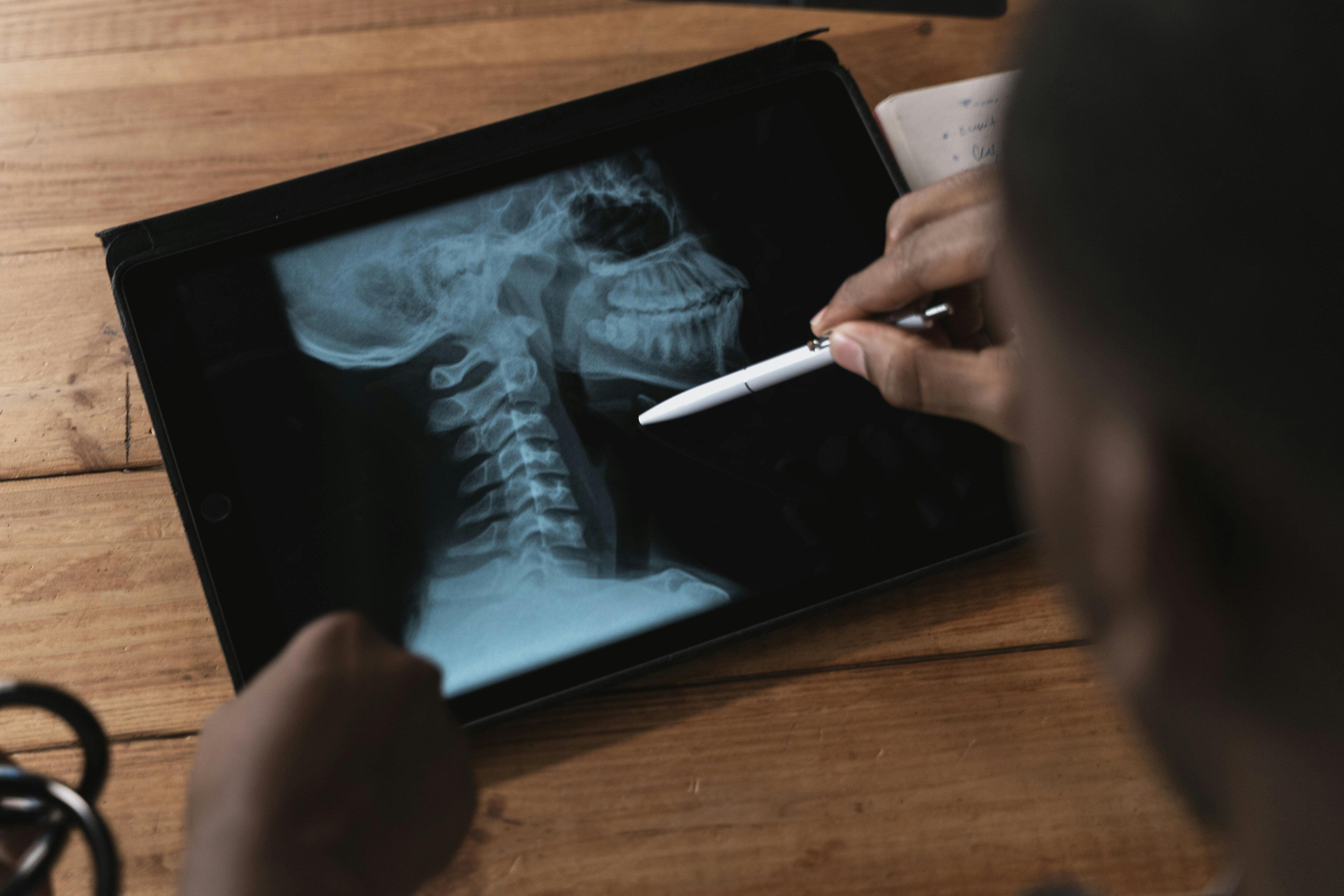 Cervical spondylosis occurs as a result of the aging of the spinal column, leading to natural wear and tear of its components. (Unsplash) Cervical spondylosis occurs as a result of the aging of the spinal column, leading to natural wear and tear of its components. (Unsplash)