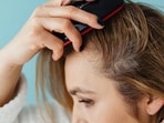 Scalp can get sunburnt too. Scalp can get sunburnt too.