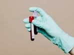 India has 2.5 lakh diagnostic labs. But only 2,200, roughly, are certified by NABL. 