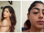 క్లబ్‌లో గొడవ, రియాలిటీ షో నటిపై ఘోరంగా దాడి- విరిగిన పన్ను, కమిలిపోయిన మొహం- వణికిపోతూ ప్రీత్ సింగ్ ఆవేదన!
