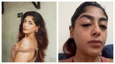క్లబ్లో గొడవ, రియాలిటీ షో నటిపై ఘోరంగా దాడి- విరిగిన పన్ను, కమిలిపోయిన మొహం- వణికిపోతూ ప్రీత్ సింగ్ ఆవేదన! క్లబ్లో గొడవ, రియాలిటీ షో నటిపై ఘోరంగా దాడి- విరిగిన పన్ను, కమిలిపోయిన మొహం- వణికిపోతూ ప్రీత్ సింగ్ ఆవేదన!