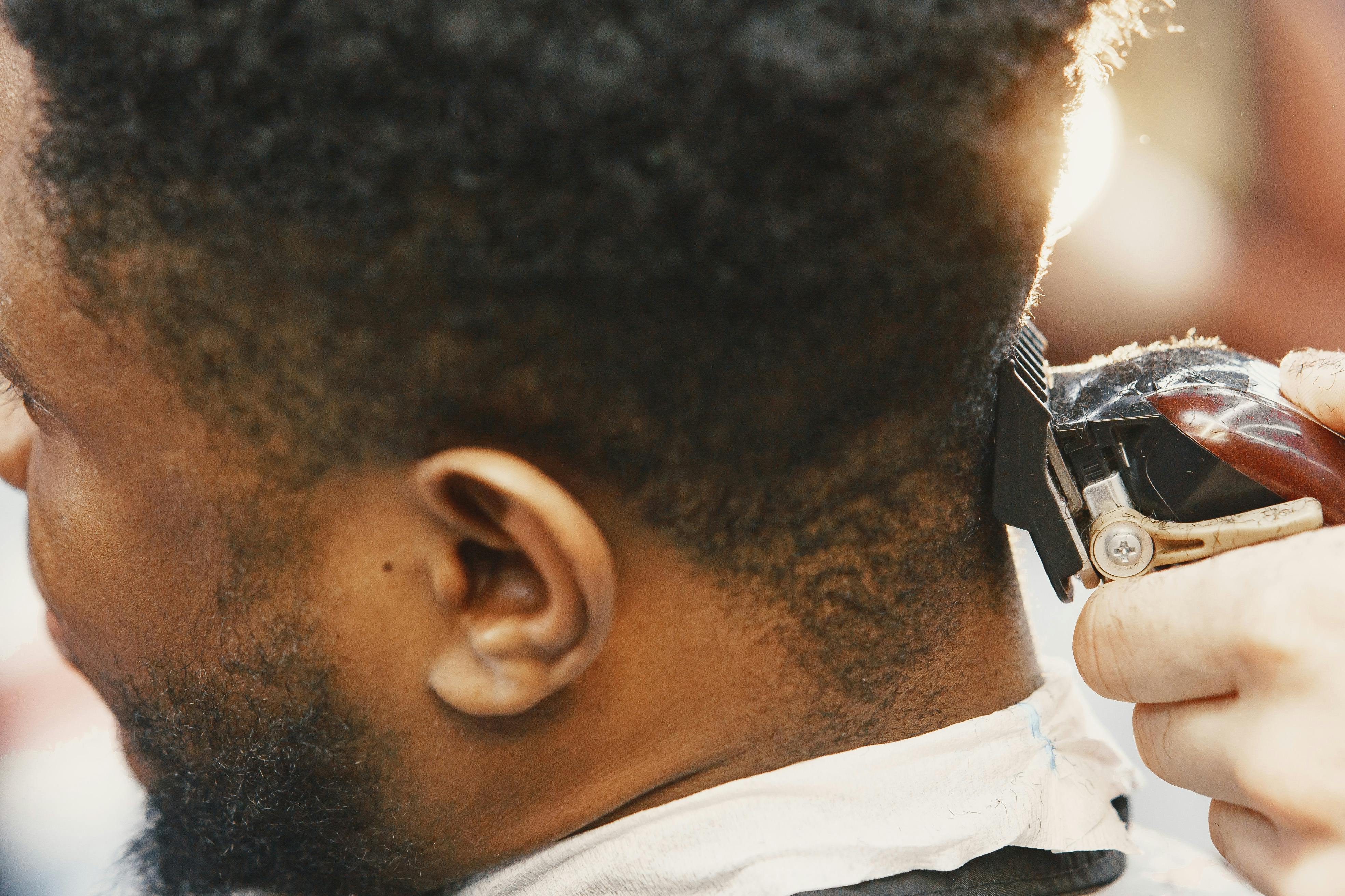 Hair transplants are getting more common among Indian men. (Pexel)