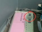 The remarks come after the BJP alleged that its election symbol had been obscured on EVMs in certain booths. 