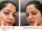 After using for three weeks, here is Plum Niacinamide range review