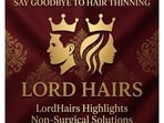 Say Goodbye to Hair Thinning: LordHairs Highlights Non-Surgical Solutions