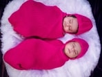 UK twins born minutes apart found to have different fathers in rare case. 