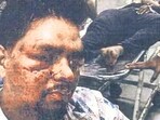HC asks DCP to explain handling of Worli bar assault case