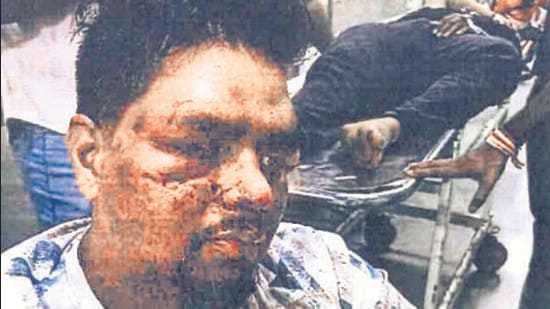 HC asks DCP to explain handling of Worli bar assault case