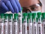 To prevent hantavirus infection, Dr Aravinda advises using protective gear during cleaning, avoiding dry sweeping, and maintaining cleanliness to deter rodent infestations. (Reuters)