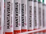 Test tubes labelled "Hantavirus positive" in this illustration taken May 7, 2026.