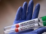 Test tubes labelled "Hantavirus positive" are held in this illustration taken May 7, 2026. 