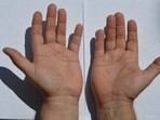 Lucky signs on Palm: మీ అరచేతిలో ఈ 5 గుర్తులు ఉన్నాయా? అఖండ లక్ష్మీ యోగం అంటే మీదే!