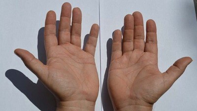 Lucky signs on Palm: మీ అరచేతిలో ఈ 5 గుర్తులు ఉన్నాయా? అఖండ లక్ష్మీ యోగం అంటే మీదే! Lucky signs on Palm: మీ అరచేతిలో ఈ 5 గుర్తులు ఉన్నాయా? అఖండ లక్ష్మీ యోగం అంటే మీదే!