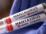 A confirmed hantavirus case has emerged among 17 Americans evacuated from a cruise ship, with another person showing mild symptoms.