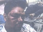 7 months on, cops to register FIR in Worli assault after HC rap