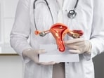 Renamed to polyendocrine metabolic ovarian syndrome, this condition affects 1 in 8 women and can lead to various health issues.(Freepik)