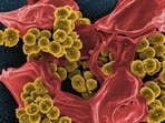Women are more prone to autoimmune diseases than men.(Unsplash)